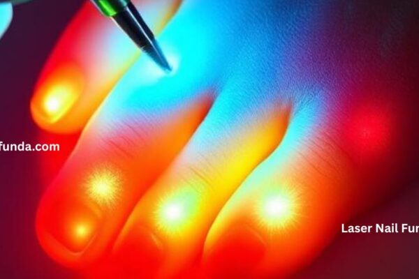 Laser nail fungus