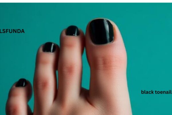 black toenails