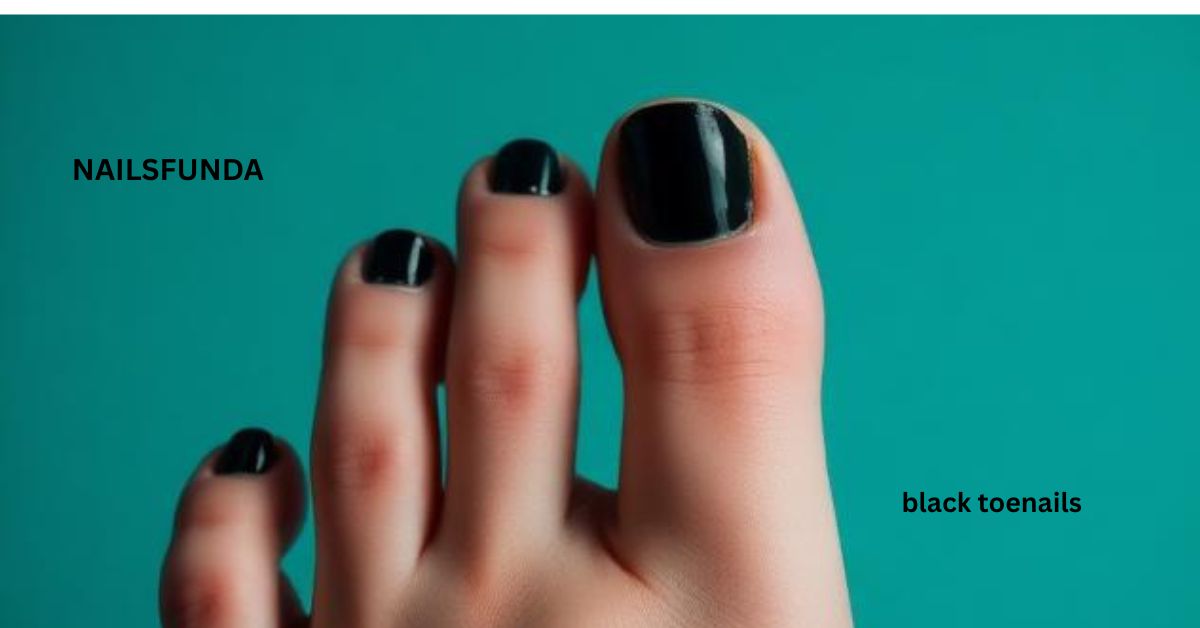 black toenails